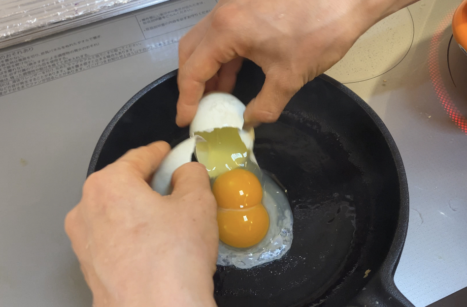 旅行中のDVTの予防